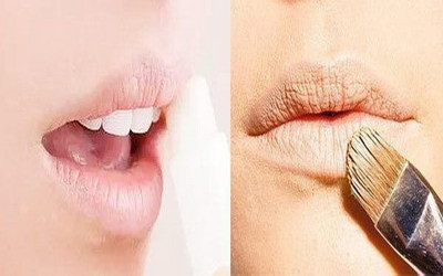 嘴皮血管瘤有什么症状