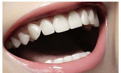 排龈后牙龈萎缩