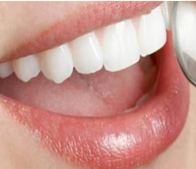 牙龈萎缩怎么治方法(经常牙龈萎缩怎么恢复方法)