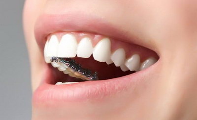 牙齿上有洞就是蛀牙吗(蛀牙就是牙齿上有黑线)