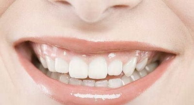 牙齿修复有几种方法呢