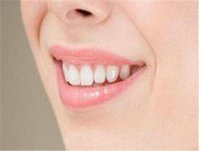 牙齿矫正能治疗脸歪吗