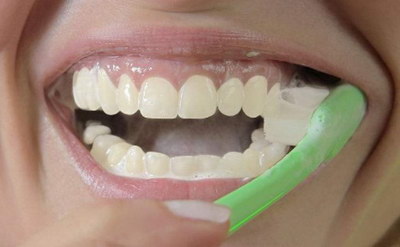牙齿有洞怎样治疗