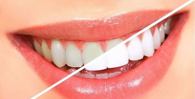 牙套戴了5年对身体有害吗(带牙套对身体有害吗)