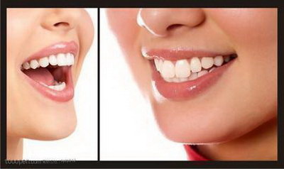 双氧水漂白牙齿危害「双氧水漂白牙齿浓度」