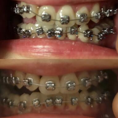 乳牙 恒牙 区别