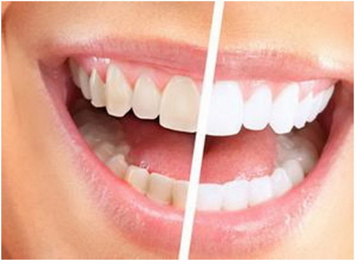 正常牙齿颜色和面积(正常牙齿的颜色图片)