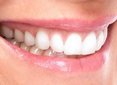 牙齿矫正可以只矫正几颗牙齿吗「牙齿矫正可以矫正几颗吗」