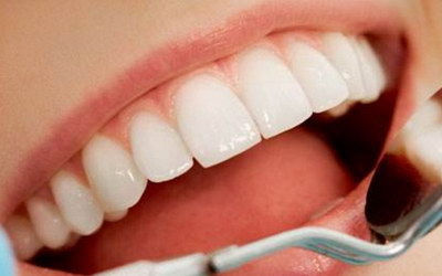 单个牙齿的牙套可以用多久