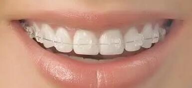 牙博士牙齿缝隙大怎么办(牙博士牙齿有缝隙怎么办)