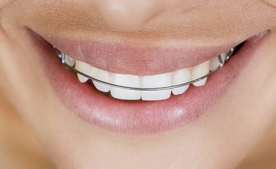 让牙齿变白的最快方法在家里(让牙齿变白的最快最健康方法)