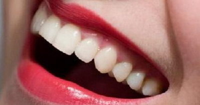 牙龈痒疼是什么原因引起(牙龈发痒是什么原因引起的)
