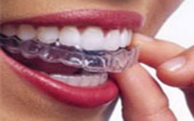 牙齿萎缩有什么方法能恢复(牙齿萎缩用什么方法治疗)