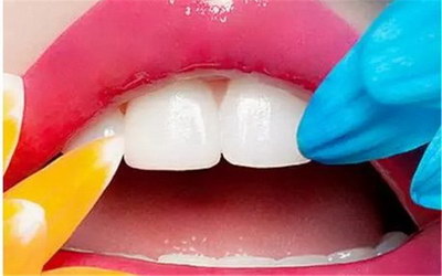 洗牙后萎缩的牙龈会在长出来么(牙龈萎缩洗牙后牙缝更大了)