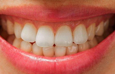拔智齿对其它牙齿有没有影响