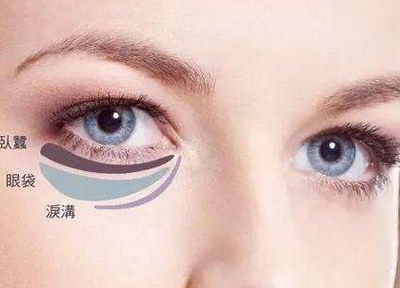 杭州哪里开双眼皮最好_杭州哪里医院开双眼皮手术最好