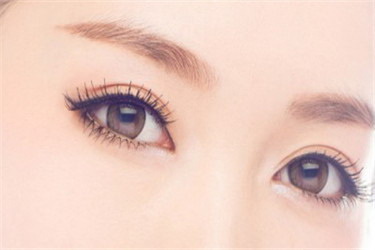 韩式三点双眼皮的恢复时间是多久_韩式三点双眼皮恢复时间