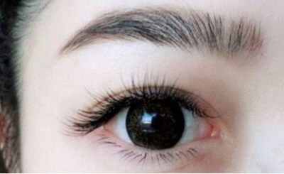 你知道埋线双眼皮失败的症状有哪些？