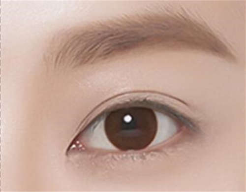 2023年阿克苏阿瓦提县超声法去眼袋官方认证指定医院