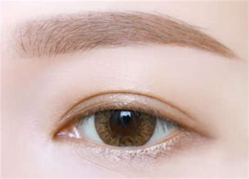 埋线双眼皮能管多久？是不是比切开的恢复快些-什么是埋线双眼皮，这种埋线双眼皮是怎么做的!