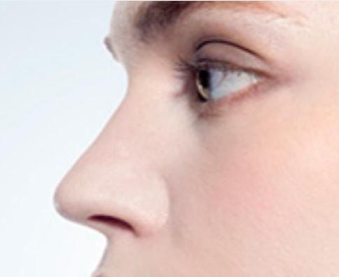 鼻缺损再造治疗方法(鼻缺损再造的治疗方法)