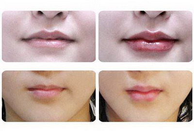 女人长唇毛什么原因造成的「女人的唇毛变白了是什么原因」