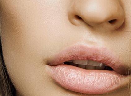 自体脂肪丰唇术的优势有哪些？