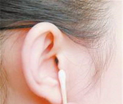 先天性耳朵畸形可以申请残疾证吗