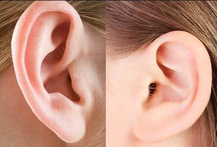 用肋软骨造耳朵一定要分两期吗「取肋软骨造耳朵之后」