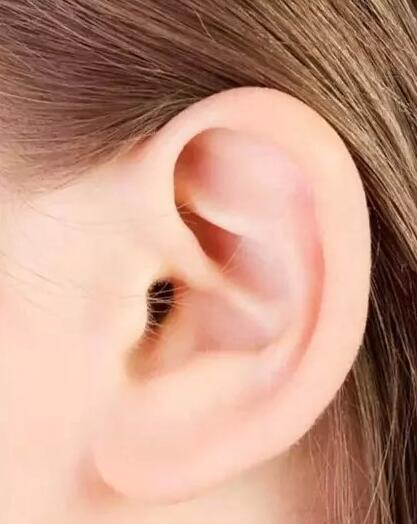 外耳再造术的方法