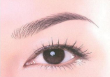 种植眉毛的手术对改善眉形有效果