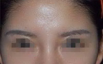 眉毛种植要多久才能达到最好效果「眉毛种植多久才能恢复」