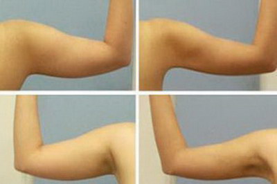 最快瘦手臂方法是怎么瘦？