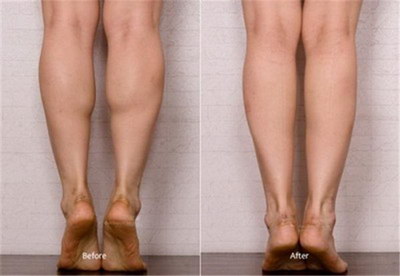 腿粗上身瘦是怎么导致的(腿粗上身瘦是怎么回事)