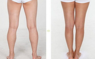 如何瘦大腿的简单方法