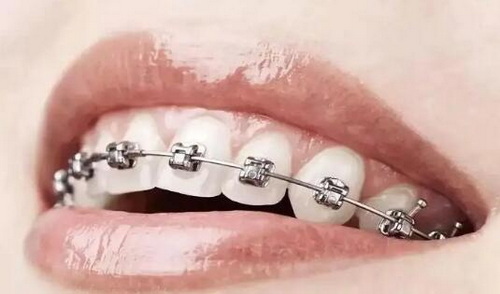 矫正牙齿属于哪科(牙齿矫正属于哪个科)