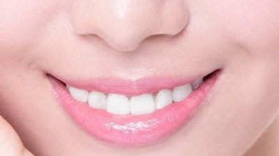 舌侧牙套和隐形牙套矫正时间(舌侧牙套和隐形牙套哪个好)