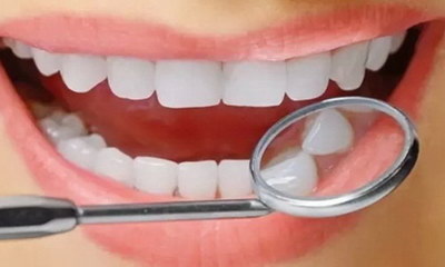牙齿矫正有什么办法收牙根(牙齿矫正除了带牙套还有什么办法)