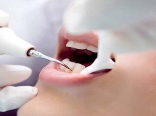 牙齿保持器应该怎么清洁_牙齿保持器应该戴多久