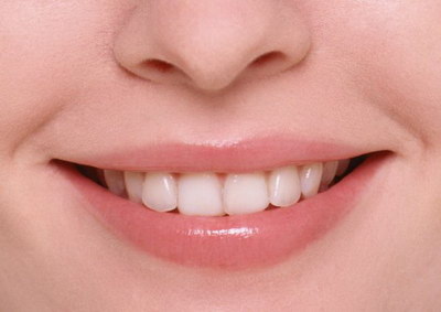 牙齿契状缺损怎么办「牙齿楔管缺损怎么办」