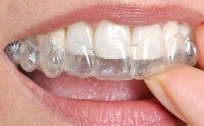 根管治疗期间可以拔智齿吗(牙齿矫正期间可以做根管治疗吗)