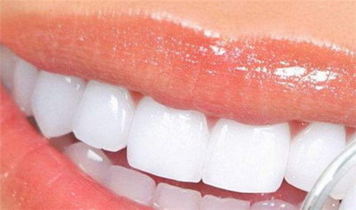 牙肉与牙齿边缘有黑点(牙肉与牙齿边缘透明)