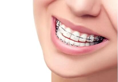 美容冠牙齿矫正步骤(美容冠矫正牙齿的6个步骤)