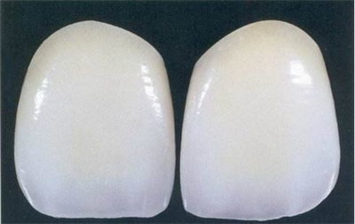洁牙和洗牙的区别(洁牙和洗牙有区别)