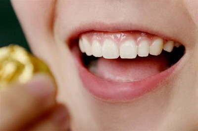 牙齿排列不齐(儿童牙齿排列不齐在多大年龄矫正好)