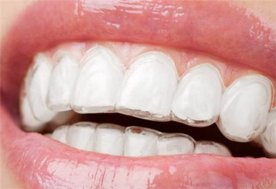牙齿要蛀的时候有什么症状