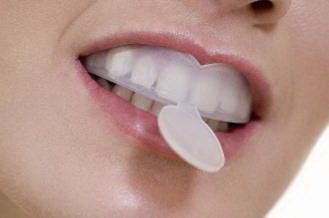 地包天牙齿矫正有年龄限制吗