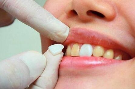 牙齿急性牙髓炎(急性牙髓炎牙齿松动)