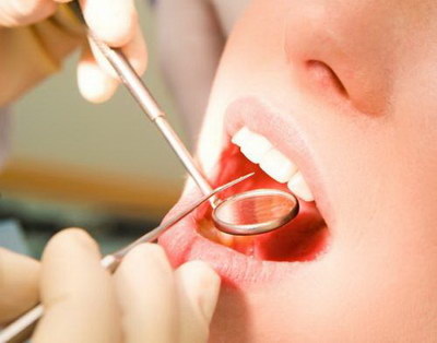 牙齿对咬感觉黏黏的有什么办法治疗(洗牙感觉牙齿好像少了点什么)