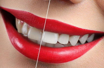 需要做根管治疗的牙齿有什么症状「需要根管治疗的牙齿有什么症状」